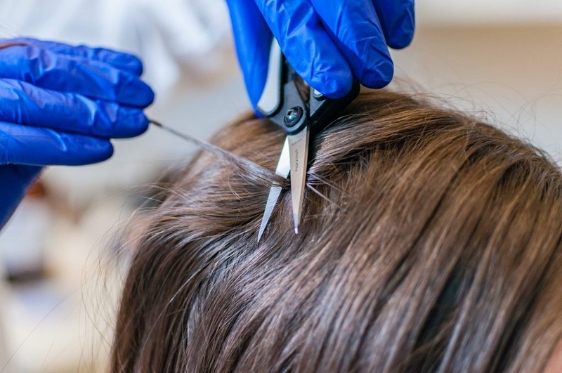 Hair follicle tests